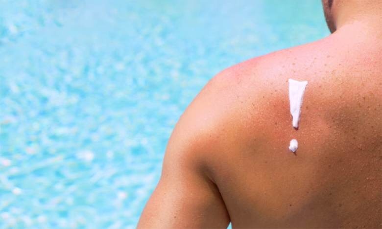 À la piscine, à la mer ou en montagne, attention aux coups de soleil !